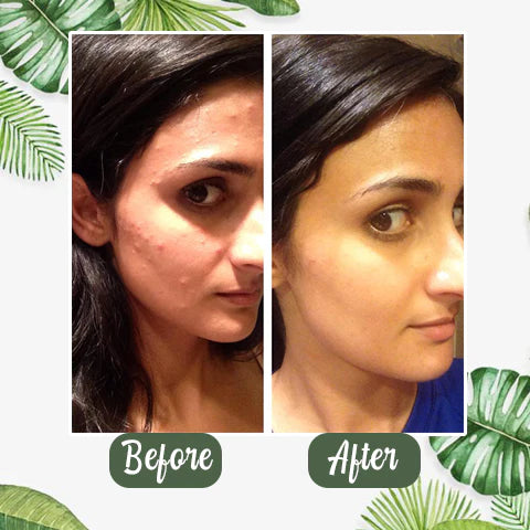 🌿Green Tea Deep Cleansing Mask Gentle. Effective. Naturally Derived.